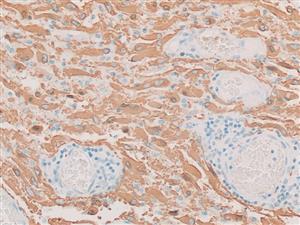 3320A | Control Slides:Immunopathology; Glial Fibrillary Acidic Protein (GFAP)